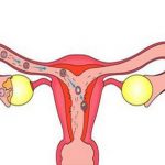 女性阴道检查全过程 大致分为四个步骤