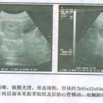 香港验血测胎儿性别，最早七周可测