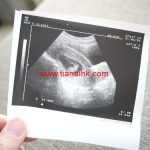 去香港做胎儿性别鉴定准吗？