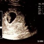 [北京] 怀孕七周以上去香港验血查的准吗？